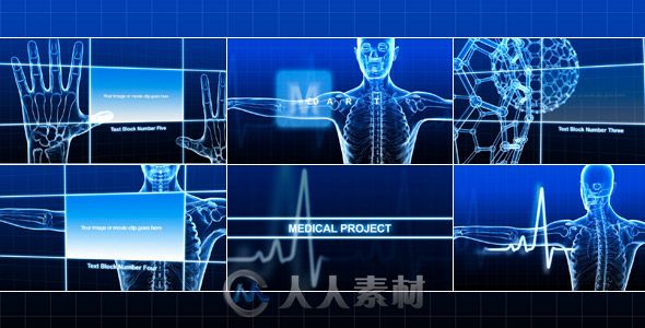 医疗人体透视包装动画AE模板 Videohive Medical Project 236064